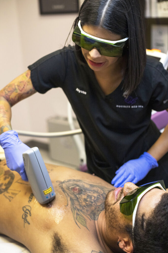 Laser hair removal with special glasses for laser hair treatments